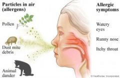 Is It possible To Be allergic To cannabis 1 Cannabis May cause symptoms Of rhinitis In susceptible individuals 250x163