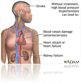 Cannabis-Hypertension-1-Hypertension-is-a-serious-condition-that-can-have-fatal-complications.jpg